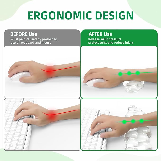 Gel Cloud Keyboard and Mouse Wrist Rest Set, Cute Ergonomic Wrist Support and Arm Support Keyboard Rest for Typing Pain Relief，Suitable for Office/Computer/Laptop/Gaming (Transparent White Set)